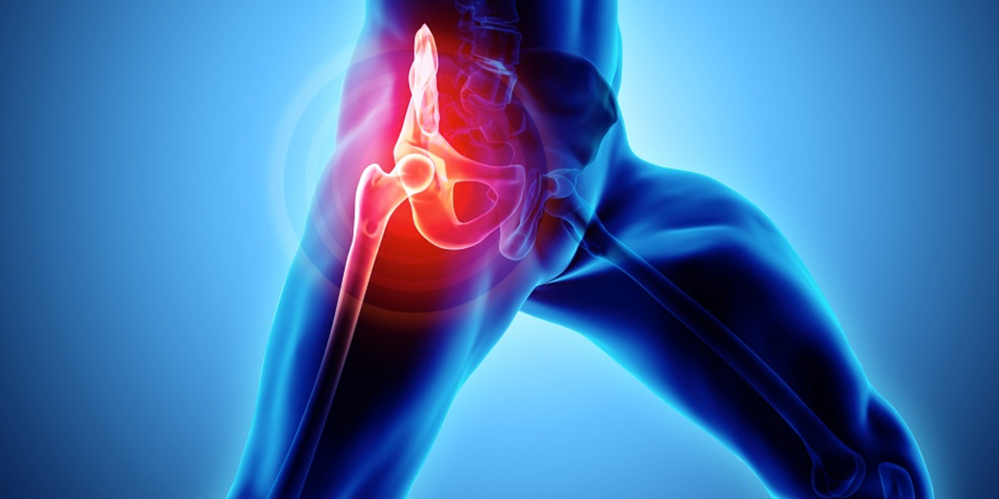 Hip Injuries Vigor360